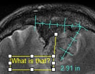 DICOM and medical image annotation and markup SDK