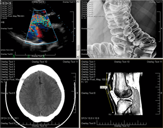 Medical Viewer Screenshot
