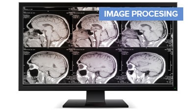 Medical Image Processing