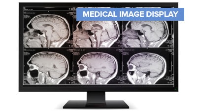 Medical Image Display