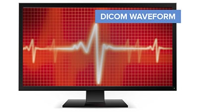 DICOM Waveform