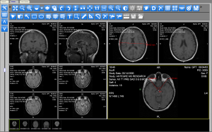 HTML5 DICOM Viewer Series Layout with multiple cells and Timeline