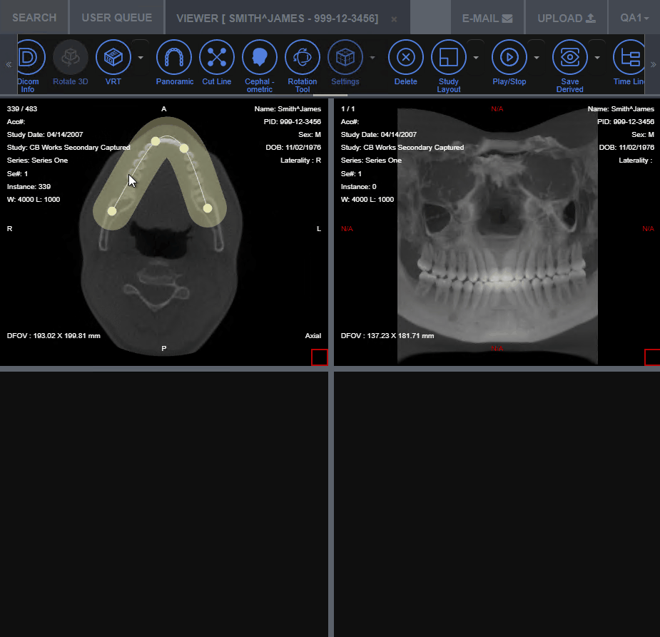 medical web viewer - paraxial slices