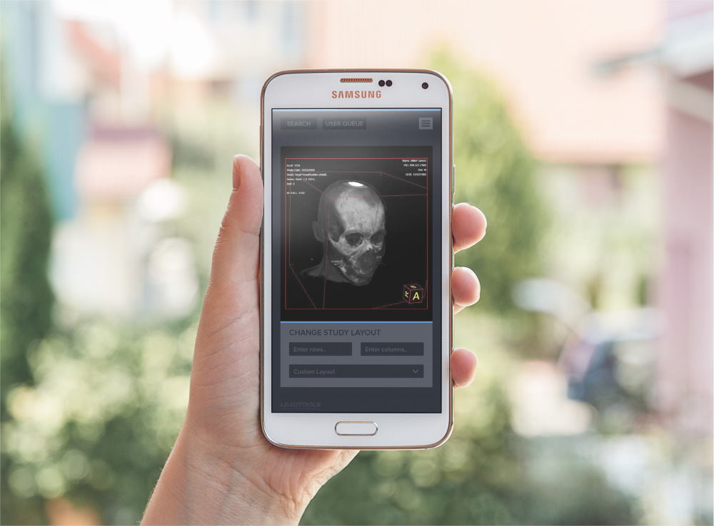 3D Volume Rendering 3D Volume Rendering