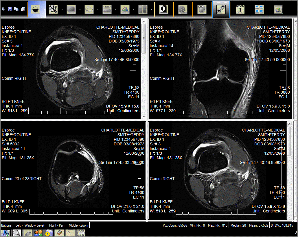 mw-viewretrievedimages.gif mw-viewretrievedimages.gif