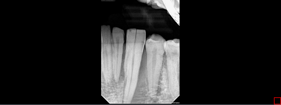 Endodontic Image