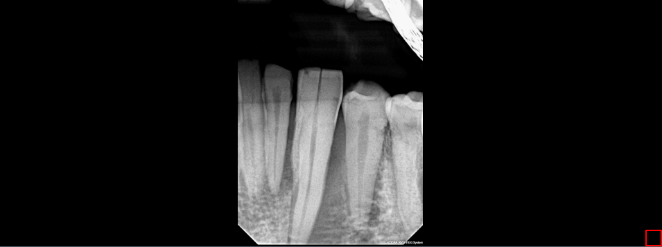 Periodontal Image