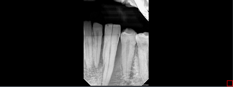 Dentin Image