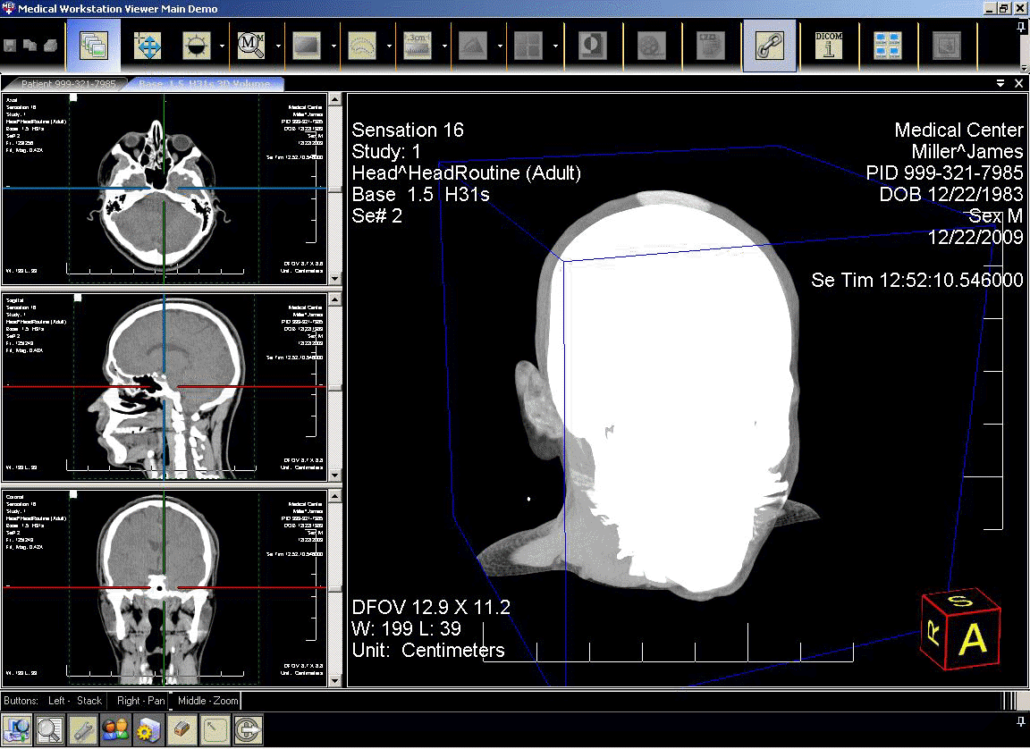 mw-3dvolume.gif