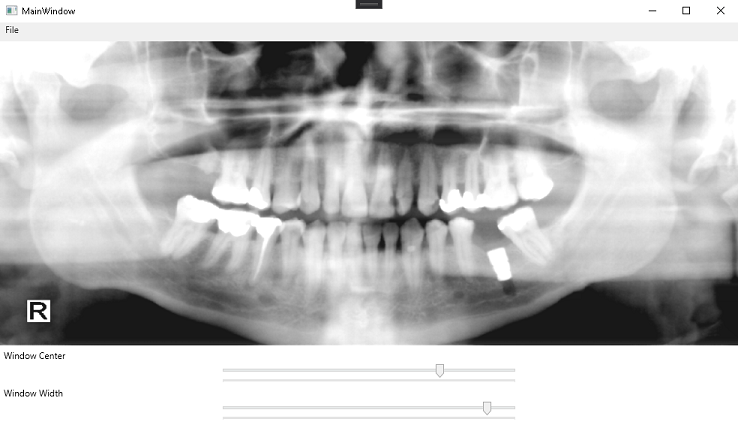 MainWindow with loaded DICOM image and window level.