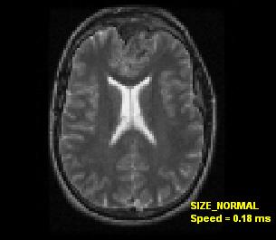 medical size normal