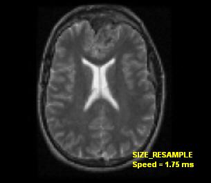 medical size resample