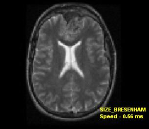 medical size bresenham