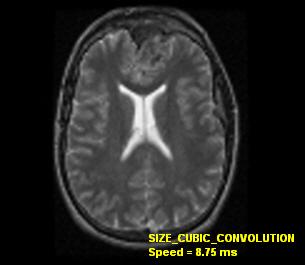 medical size cubic convolution