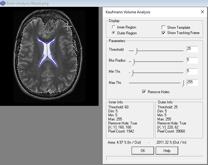 Brain Analysis Function - After