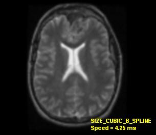 medical size cubic b-spline