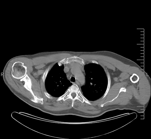 CT Scan Image