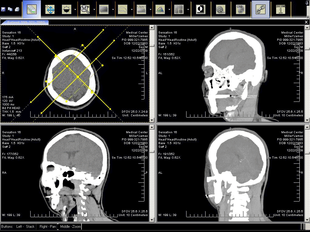 mw-mprscreen.gif