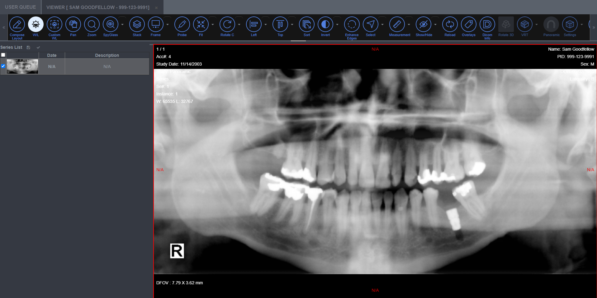 View DICOM Image