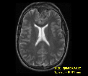 medical size quadratic