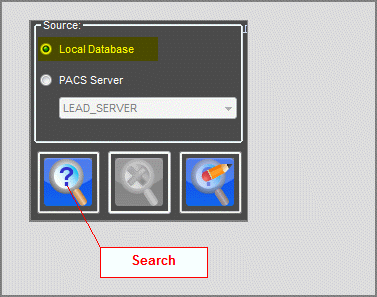 mw-selectlocaldatabase.gif