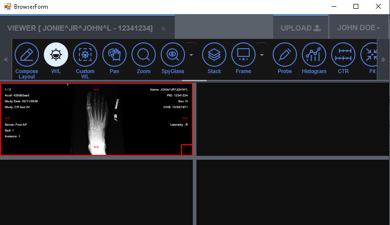 Medical Web Viewer