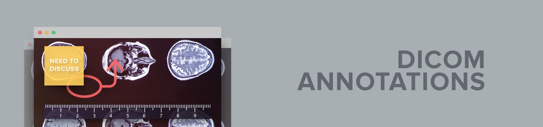 DICOM Annotations