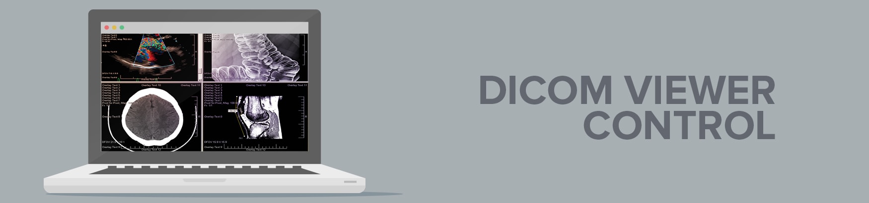 DICOM Viewer Control banner