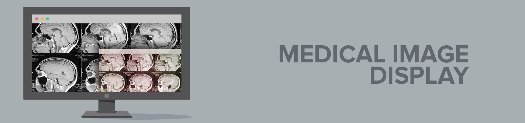 Medical Image Display