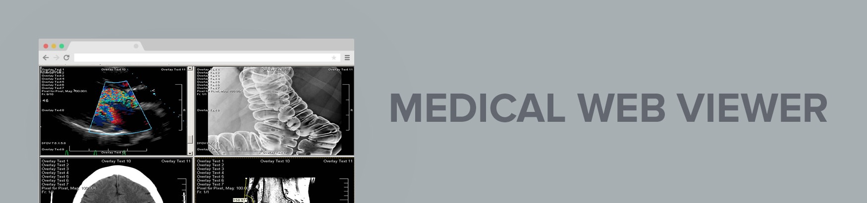 Medical Web Viewer