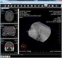 Medical Web Viewer Framework ~ Rich Client (IE only) screenshot