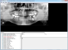 DICOM screenshot
