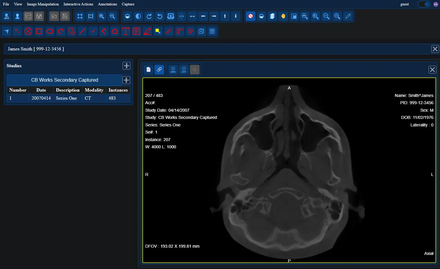 React Medical Web Viewer screenshot