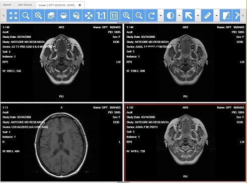 Medical Web Viewer screenshot