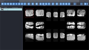 Dental Web Viewer screenshot