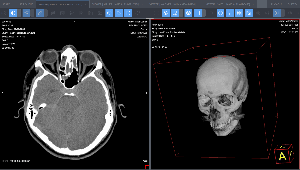 Medical Web Viewer screenshot